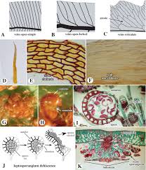 Attēlu rezultāti vaicājumam “Saelania glaucescens sporophyte”