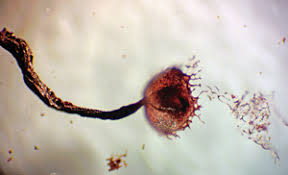 Attēlu rezultāti vaicājumam “Cribraria atrofusca spores”