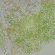 Attēlu rezultāti vaicājumam “Chaenotheca chlorella”