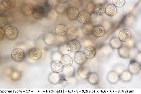 Attēlu rezultāti vaicājumam “Dianema depressum”