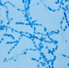 Attēlu rezultāti vaicājumam “Campylopus pyriformis sporophyte”