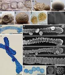 Attēlu rezultāti vaicājumam “Lycogala sp.”