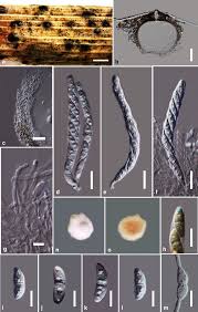 Attēlu rezultāti vaicājumam “Rosellinia desmazieri spores”