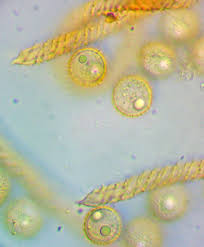 Attēlu rezultāti vaicājumam “Trichiaceae, Hemitrichiaceae, Arcyriaceae”