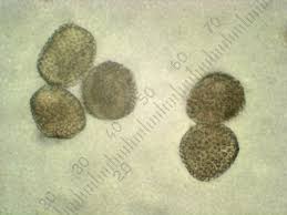 Attēlu rezultāti vaicājumam “Pucciniastrum areolatum”