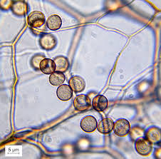 Attēlu rezultāti vaicājumam “Stemonitis axifera spores”