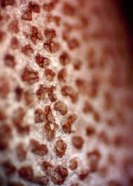 Attēlu rezultāti vaicājumam “Lycogala fuscoolearium macro”