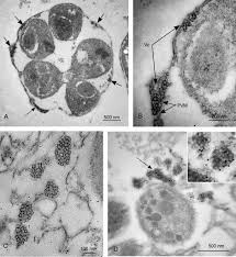 Attēlu rezultāti vaicājumam “Colloderma oculatum plasmodium”
