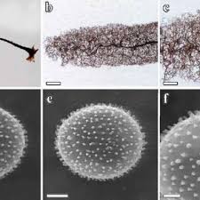 Attēlu rezultāti vaicājumam “Stemonitopsis subcaespitosa spores”