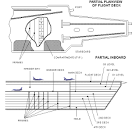 The Hull