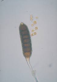 Attēlu rezultāti vaicājumam “Phragmidium sp.”