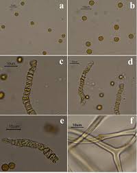 Attēlu rezultāti vaicājumam “Claustria didermoides spores”