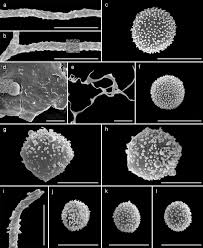 Attēlu rezultāti vaicājumam “Perichaena depressa spores”
