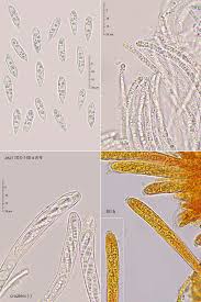 Attēlu rezultāti vaicājumam “Hymenoscyphus fructigenus”