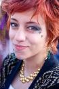woman with iris coloboma (a