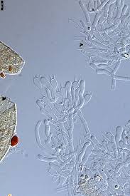 Attēlu rezultāti vaicājumam “Badhamia juliae spores”