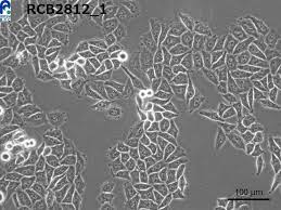 Attēlu rezultāti vaicājumam “Bryum funkii cells”