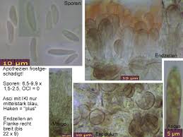 Attēlu rezultāti vaicājumam “Mollisia amenticola”
