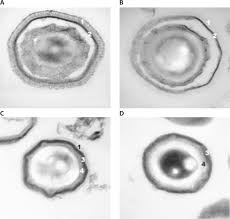 Attēlu rezultāti vaicājumam “Enteridium corticatum spores”