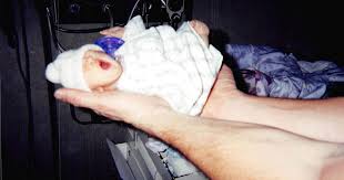 Image result for Nanismo Primordial