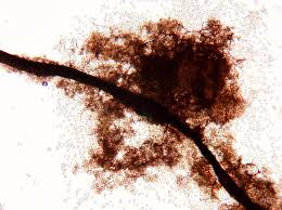 Attēlu rezultāti vaicājumam “Dianema depressum plasmodium”