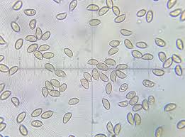 Attēlu rezultāti vaicājumam “Stemonitopsis hyperopta var. landewaldii spores”