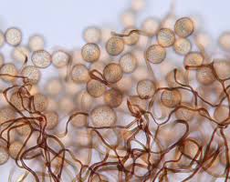 Attēlu rezultāti vaicājumam “Comatricha pulchella spores”