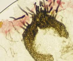 Attēlu rezultāti vaicājumam “Lichenoconium xanthoriae”