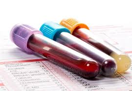 Image result for blood