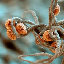 Attēlu rezultāti vaicājumam “Trichia flavicoma spores”