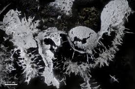 Attēlu rezultāti vaicājumam “Physarum bryomacrocarpum spores”