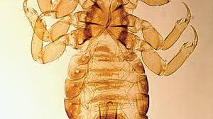 Attēlu rezultāti vaicājumam “Pediculus humanus capitis”