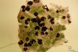 Attēlu rezultāti vaicājumam “Lichenoconium xanthoriae”