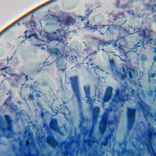 Attēlu rezultāti vaicājumam “Micarea sp.”