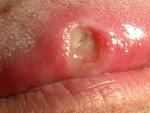 Dermatology Image Atlas: Dermatology Images