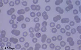 Attēlu rezultāti vaicājumam “Lamproderma violaceum plasmodium”