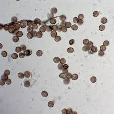 Attēlu rezultāti vaicājumam “Hemitrichia decipiens”