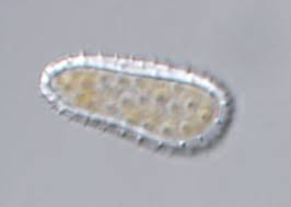 Attēlu rezultāti vaicājumam “Melampsoridium sp.”