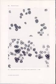 Attēlu rezultāti vaicājumam “Diderma ochraceum young”