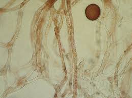 Attēlu rezultāti vaicājumam “Lamproderma pseudomaculatum spores”