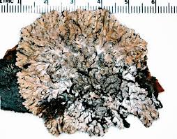 Attēlu rezultāti vaicājumam “Physconia detersa”