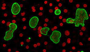 Attēlu rezultāti vaicājumam “Fuligo leviderma plasmodium”