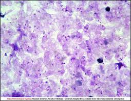 Attēlu rezultāti vaicājumam “Reticularia lobata plasmodium”