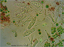 Attēlu rezultāti vaicājumam “Xanthoria polycarpa”