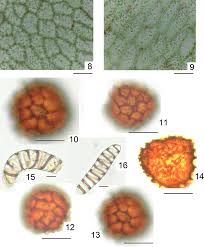 Attēlu rezultāti vaicājumam “Fossombronia wondraczekii spores”