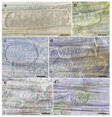 Attēlu rezultāti vaicājumam “Sanionia uncinata  sporophyte”