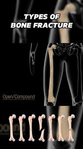 Image result for   㖃      R X v  