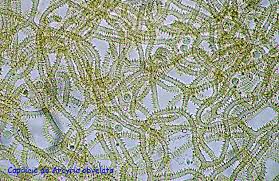 Attēlu rezultāti vaicājumam “Heterotrichia obvelata (syn. Arcyria obvelata)”