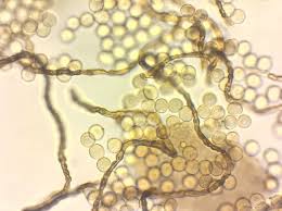 Attēlu rezultāti vaicājumam “Ophiotheca chrysosperma macro”