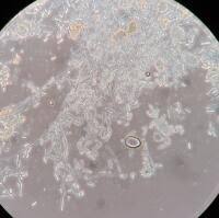 Attēlu rezultāti vaicājumam “Coleosporium sp.”